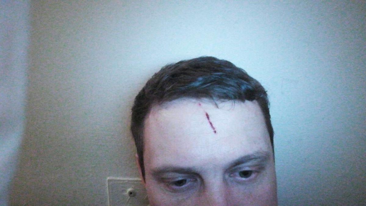 На Київщині в Українці скоєно напад на депутата від кропу Максима Винника, який виступав проти забудови набережної міста